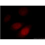 AKAP7 Rabbit Polyclonal Antibody (12591-1-AP)