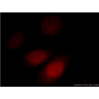 AKAP7 Rabbit Polyclonal Antibody (12591-1-AP)
