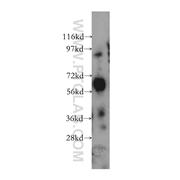 ARSG Rabbit Polyclonal Antibody (12328-1-AP)