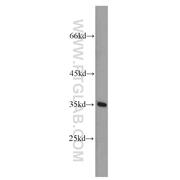 DPPA2 Rabbit Polyclonal Antibody (12689-1-AP)