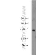RAB38 Rabbit Polyclonal Antibody (12234-1-AP)