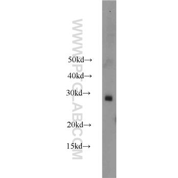 RAB38 Rabbit Polyclonal Antibody (12234-1-AP)