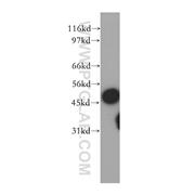 SUCLA2 Rabbit Polyclonal Antibody (12627-1-AP)