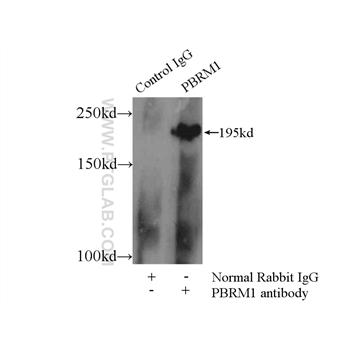 PBRM1 Rabbit Polyclonal Antibody (12563-1-AP)