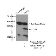 TRUB1 Rabbit Polyclonal Antibody (12520-1-AP)