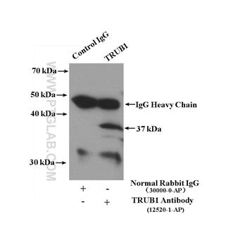 TRUB1 Rabbit Polyclonal Antibody (12520-1-AP)