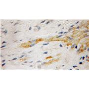 RABGEF1 Rabbit Polyclonal Antibody (12735-1-AP)