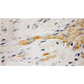 RABGEF1 Rabbit Polyclonal Antibody (12735-1-AP)