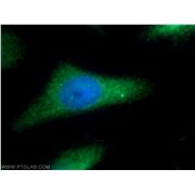 SGCE Rabbit Polyclonal Antibody (12407-1-AP)