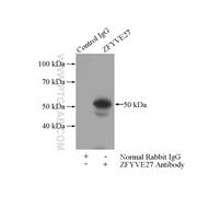 ZFYVE27 Rabbit Polyclonal Antibody (12680-1-AP)