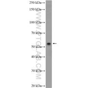 KPNA6 Rabbit Polyclonal Antibody (12366-2-AP)