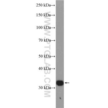 EBAG9 Rabbit Polyclonal Antibody (12255-1-AP)