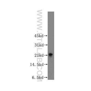 TAGLN3 Rabbit Polyclonal Antibody (12246-1-AP)