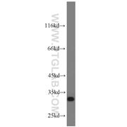 CHMP2B Rabbit Polyclonal Antibody (12527-1-AP)