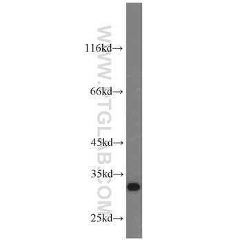 CHMP2B Rabbit Polyclonal Antibody (12527-1-AP)
