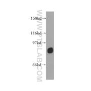 TSGA10 Rabbit Polyclonal Antibody (12593-1-AP)