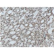 PRNP Rabbit Polyclonal Antibody (12555-1-AP)