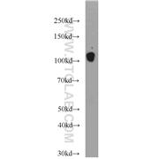 CDH13 Rabbit Polyclonal Antibody (12618-1-AP)