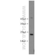 POLR1D Rabbit Polyclonal Antibody (12254-1-AP)