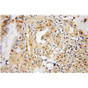 SNX7 Rabbit Polyclonal Antibody (12269-1-AP)