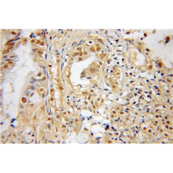 SNX7 Rabbit Polyclonal Antibody (12269-1-AP)