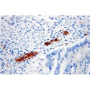CALB2 Rabbit Polyclonal Antibody (12278-1-AP)
