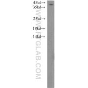 ABHD5 Rabbit Polyclonal Antibody (12201-1-AP)