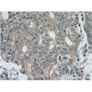 KLK11 Rabbit Polyclonal Antibody (12698-1-AP)