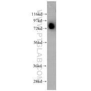 AKAP10 Rabbit Polyclonal Antibody (12356-1-AP)