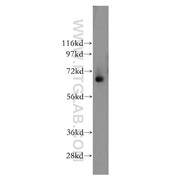TPP1 Rabbit Polyclonal Antibody (12479-1-AP)