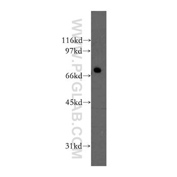 PPP2R1B Rabbit Polyclonal Antibody (12621-1-AP)