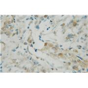 PDCD4 Rabbit Polyclonal Antibody (12587-1-AP)