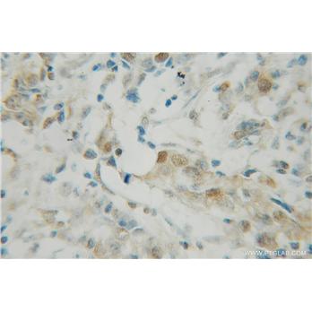 PDCD4 Rabbit Polyclonal Antibody (12587-1-AP)