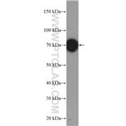 UBE3C Rabbit Polyclonal Antibody (12333-1-AP)