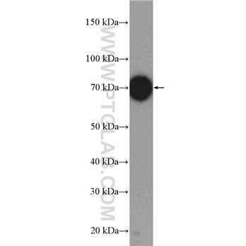 UBE3C Rabbit Polyclonal Antibody (12333-1-AP)