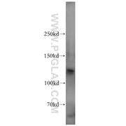 WWP2 Rabbit Polyclonal Antibody (12197-1-AP)