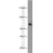 TTC8 Rabbit Polyclonal Antibody (12505-1-AP)