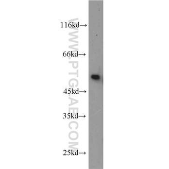 TTC8 Rabbit Polyclonal Antibody (12505-1-AP)