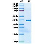 Human HLA-G Free Heavy Chain Protein (HLG-HE41F)