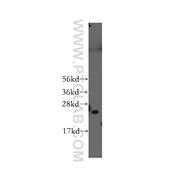 PSMD10 Rabbit Polyclonal Antibody (12342-2-AP)