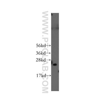 PSMD10 Rabbit Polyclonal Antibody (12342-2-AP)