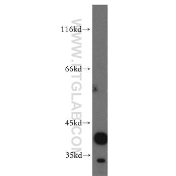 CANT1 Rabbit Polyclonal Antibody (12164-1-AP)