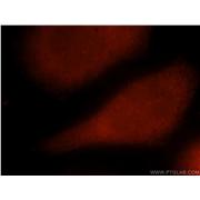 SMAD5 Rabbit Polyclonal Antibody (12167-1-AP)