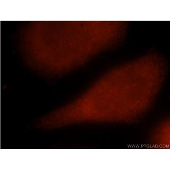 SMAD5 Rabbit Polyclonal Antibody (12167-1-AP)