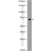 ANXA6 Rabbit Polyclonal Antibody (12542-1-AP)
