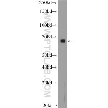 ANXA6 Rabbit Polyclonal Antibody (12542-1-AP)