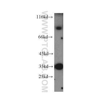 MUM1 Rabbit Polyclonal Antibody (12682-1-AP)