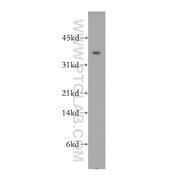 CIAPIN1 Rabbit Polyclonal Antibody (12638-1-AP)