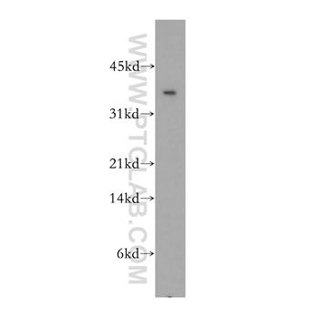 CIAPIN1 Rabbit Polyclonal Antibody (12638-1-AP)