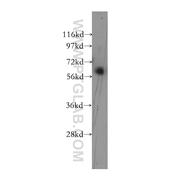 RFX5 Rabbit Polyclonal Antibody (12137-1-AP)